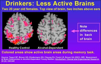 What are the effects of alcohol on the brain?